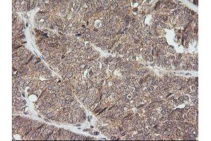 Image no. 2 for anti-NFKB Inhibitor Interacting Ras-Like 1 (NKIRAS1) antibody (ABIN1499742) (NKIRAS1 anticorps)