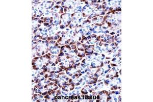 Immunohistochemistry (IHC) image for anti-Coiled-Coil Domain Containing 50 (CCDC50) antibody (ABIN2997838)