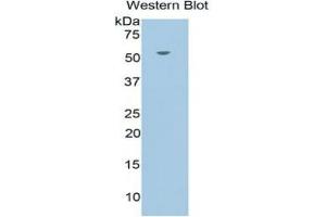 WB of Protein Standard: different control antibodies against Highly purified E.
