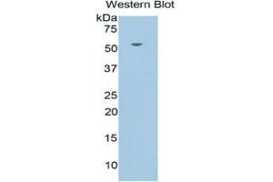 WB of Protein Standard: different control antibodies against Highly purified E. (Glucocorticoid Receptor Kit ELISA)