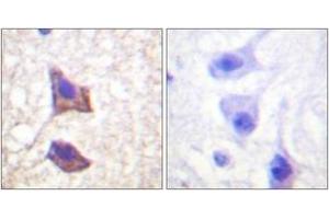 Immunohistochemistry analysis of paraffin-embedded human brain tissue, using CD130/gp130 (Ab-782) Antibody. (CD130/gp130 anticorps  (AA 748-797))