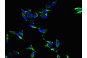 Immunofluorescent analysis of Hela cells using ABIN7158350 at dilution of 1:100 and Alexa Fluor 488-congugated AffiniPure Goat Anti-Rabbit IgG(H+L)