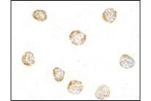 anti-NFKB Inhibitor Interacting Ras-Like 1 (NKIRAS1) (C-Term) antibody