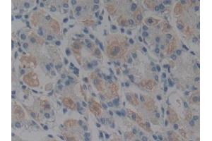 Detection of GPX1 in Human Stomach Tissue using Polyclonal Antibody to Glutathione Peroxidase 1 (GPX1)