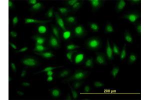 Immunofluorescence of monoclonal antibody to ZWINT on HeLa cell.