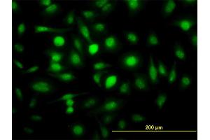 Immunofluorescence of monoclonal antibody to ZWINT on HeLa cell. (ZWINT anticorps  (AA 1-277))