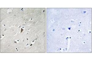 Immunohistochemistry analysis of paraffin-embedded human brain, using PDK1 (Phospho-Tyr9) Antibody. (PDPK1 anticorps  (pTyr9))