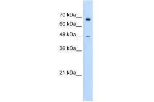 WB Suggested Anti-KLHL25 Antibody Titration:  0. (KLHL25 anticorps  (N-Term))