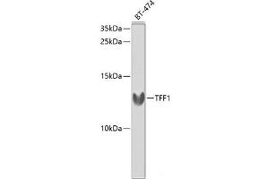 Western blot analysis of extracts of BT-474 cells using TFF1 Polyclonal Antibody at dilution of 1:1000. (TFF1 anticorps)