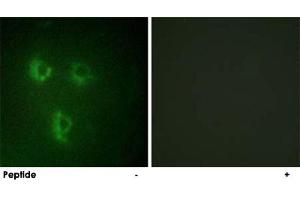 Immunofluorescence analysis of HUVEC cells, using PMEPA1 polyclonal antibody . (PMEPA1 anticorps)