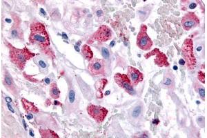 anti-Bombesin-Like Receptor 3 (BRS3) (Cytoplasmic Domain) antibody