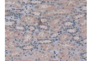 Detection of GbL in Human Kidney Tissue using Polyclonal Antibody to G Protein Beta Subunit Like Protein (GbL)