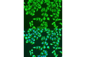 Immunofluorescence analysis of U2OS cells using RhoA antibody (ABIN7269865) at dilution of 1:100.