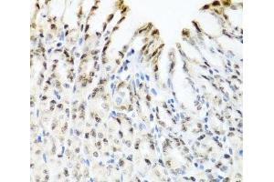 Immunohistochemistry of paraffin-embedded Mouse stomach using YTHDF3 Polyclonal Antibody at dilution of 1:100 (40x lens).