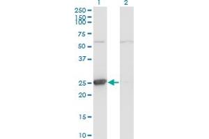 Western Blot analysis of TK1 expression in transfected 293T cell line by TK1 monoclonal antibody (M06), clone 3E2. (TK1 anticorps  (AA 1-234))