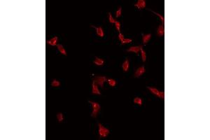ABIN6275013 staining Hela by IF/ICC. (CKLF anticorps)