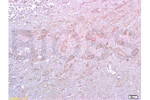 Formalin-fixed and paraffin embedded rat brain labeled with Rabbit Anti 5-HTR2A/HTR2A Polyclonal Antibody, Unconjugated (ABIN737016) at 1:200 followed by conjugation to the secondary antibody and DAB staining (HTR2A anticorps  (AA 65-160))