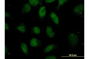 Immunofluorescence of monoclonal antibody to POU5F1 on HeLa cell. (OCT4 anticorps  (AA 81-164))