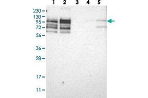 Western blot analysis of Lane 1: RT-4, Lane 2: U-251 MG, Lane 3: Human Plasma, Lane 4: Liver, Lane 5: Tonsil with PPP1R13B polyclonal antibody  at 1:250-1:500 dilution. (PPP1R13B anticorps)