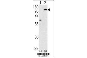 Western blot analysis of PRKCE using rabbit polyclonal PKC epsilon Antibody using 293 cell lysates (2 ug/lane) either nontransfected (Lane 1) or transiently transfected with the PRKCE gene (Lane 2).