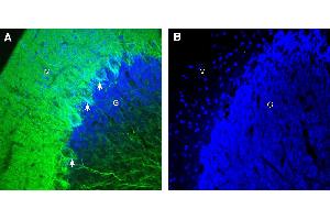 Expression of GPR158 in rat cerebellum. (GPR158 anticorps  (Intracellular))