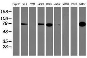 Image no. 1 for anti-phosphofructokinase, Platelet (PFKP) antibody (ABIN1500166) (PFKP anticorps)
