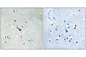 Immunohistochemical analysis of paraffin-embedded human brain tissue using APLP2 (Phospho-Tyr755) antibody (left)or the same antibody preincubated with blocking peptide (right). (APLP2 anticorps  (pTyr755))
