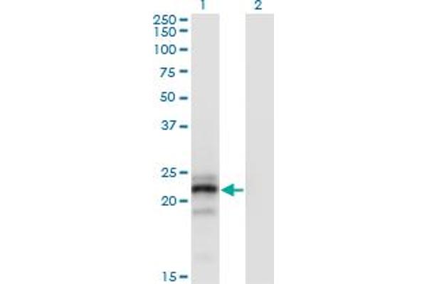 CGB anticorps  (AA 70-165)
