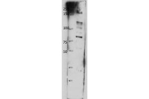 Western Blot of Rabbit anti-ABCB8 antibody.