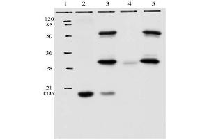 IP analysis of HPV-11 E7 protein. (Human Papilloma Virus 11 E7 (HPV-11 E7) (AA 36-70) anticorps)