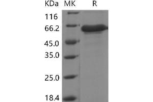 Western Blotting (WB) image for Insulin-Like Growth Factor Binding Protein 7 (IGFBP7) protein (Fc Tag) (ABIN7320037)