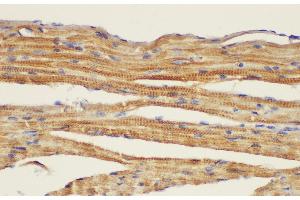 Immunohistochemistry of paraffin-embedded Mouse heart using CD146 Ployclonal Antibody at dilution of 1:50. (MCAM anticorps)