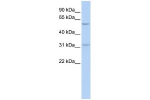 WB Suggested Anti-BTBD14B Antibody Titration:  0. (NAC1 anticorps  (Middle Region))