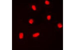 Immunofluorescent analysis of BAF53A staining in K562 cells. (BAF53A anticorps  (Center))