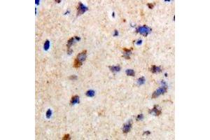 Immunohistochemical analysis of CCDC52 staining in rat brain formalin fixed paraffin embedded tissue section. (SPICE1 anticorps)