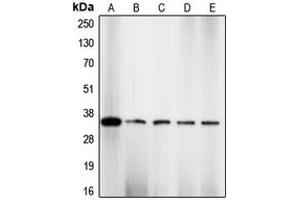 Western blot analysis of CDK2 (pT160) expression in NIH3T3 (A), HeLa (B), COLO205 (C), K562 (D), A2780 (E) whole cell lysates. (CDK2 anticorps  (pSer160))