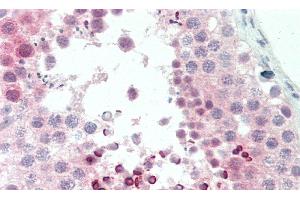 Detection of CDKN2D in Human Testis Tissue using Polyclonal Antibody to Cyclin Dependent Kinase Inhibitor 2D (CDKN2D)