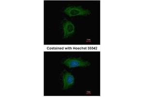 ICC/IF Image Immunofluorescence analysis of methanol-fixed HeLa, using PPP2R1A, antibody at 1:500 dilution. (PPP2R1A anticorps  (Center))