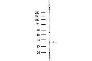 anti-Cathepsin L1 (CTSL1) (Internal Region) antibody