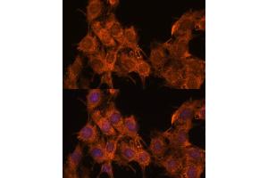 Immunofluorescence analysis of C6 cells using SNX15 antibody  at dilution of 1:100. (SNX15 anticorps  (AA 1-342))