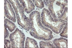 Image no. 1 for anti-Keratin Associated Protein 2-4 (KRTAP2-4) (AA 1-128) antibody (ABIN1490568)