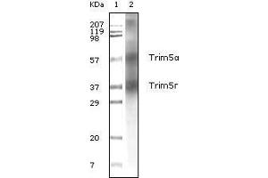 Western blot analysis using Trim5α mouse mAb against human breast carcinoma tissue lysate. (TRIM5 anticorps)