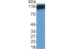 Detection of CD26 in HepG2 cell lysate using Polyclonal Antibody to Cluster Of Differentiation 26 (CD26) (DPP4 anticorps  (AA 29-178))