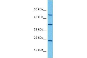 Host:  Rabbit  Target Name:  ATP6V0C  Sample Tissue:  Human RPMI 8226 Whole Cell  Antibody Dilution:  1ug/ml (ATP6V0C anticorps  (Middle Region))