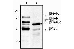 Western blot analysis using anti-β-Pix (mouse), pAb .