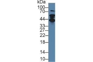 Western blot analysis of Human Lung lysate, using Rabbit Anti-Human TMPO Antibody (1 µg/ml) and HRP-conjugated Goat Anti-Rabbit antibody (abx400043, 0. (Thymopoietin anticorps  (AA 1-243))