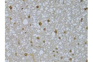 Immunohistochemistry of paraffin-embedded rat spleen using HDGFRP3 Rabbit pAb (ABIN6133452, ABIN6141699, ABIN6141700 and ABIN6224799) at dilution of 1:150 (40x lens).