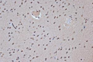 Immunohistochemistry of paraffin-embedded rat brain using SRSF3 Rabbit mAb (ABIN7270216) at dilution of 1:100 (40x lens). (SRSF3 anticorps)