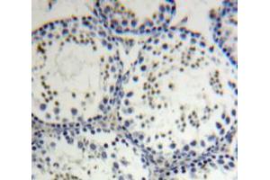 Used in DAB staining on fromalin fixed paraffin-embedded Testis tissue