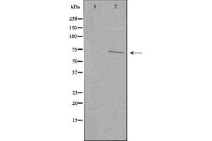 Western blot analysis of extracts from COLO205 cells, using CDKAL antibody. (CDKAL1 anticorps  (N-Term))